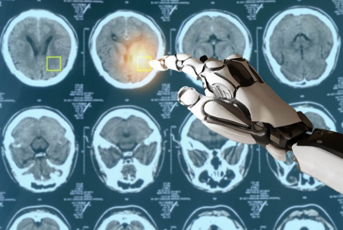 Medical Image Analysis thumbnail